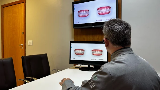 Lentes de Contato Dental: O segredo das transformações de sorriso em Goiânia